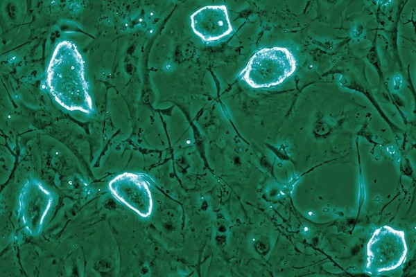 Механизм «заморозки» беременности указал учёным способ лечения рака