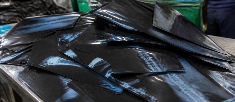 Жители Прикамья сдали более 200 кг рентгеновских снимков Жители Пермского края сдали в экопункт более 20...
